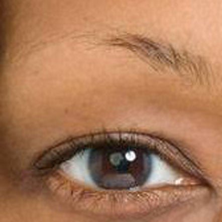 Is There A Cure To Thinning Eyelashes and Eyebrows?