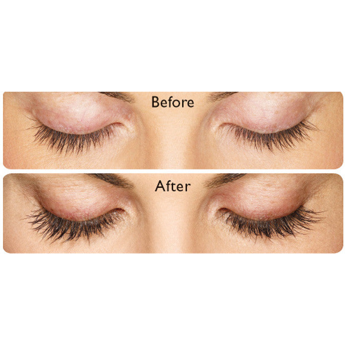Careprost before and after